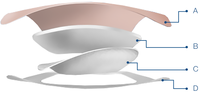 Aufbau Aquacel Schaumverband / Wundversorgung