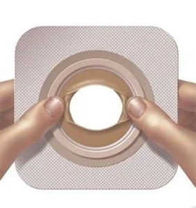 ConvaTec Moldable Technology™ Skin Barrier