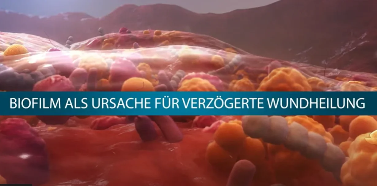 Grafische Benutzeroberfläche, Text