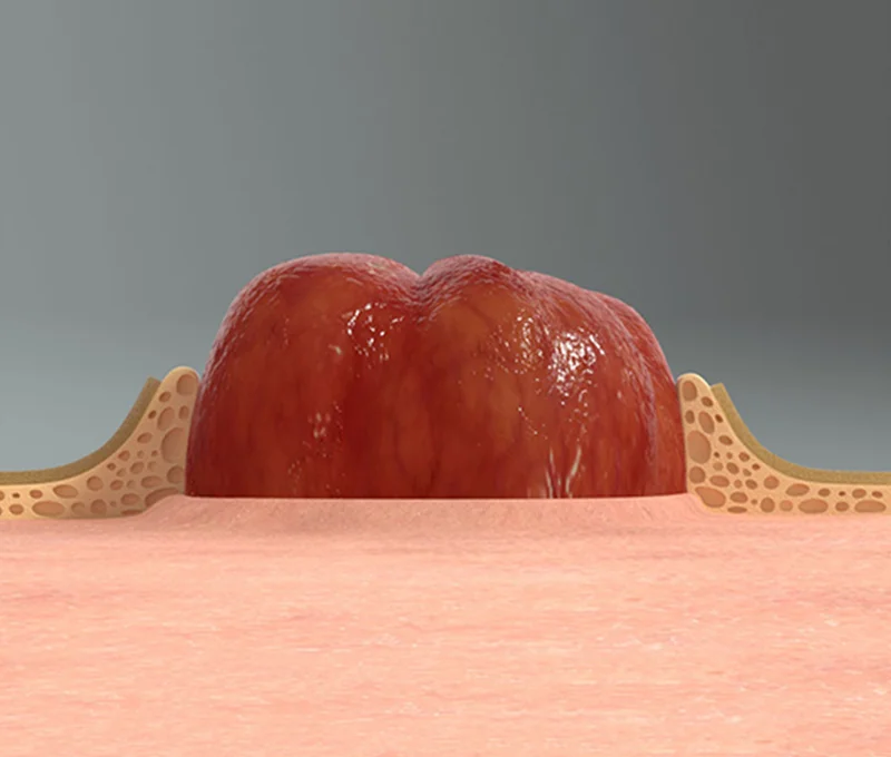 a red and white object