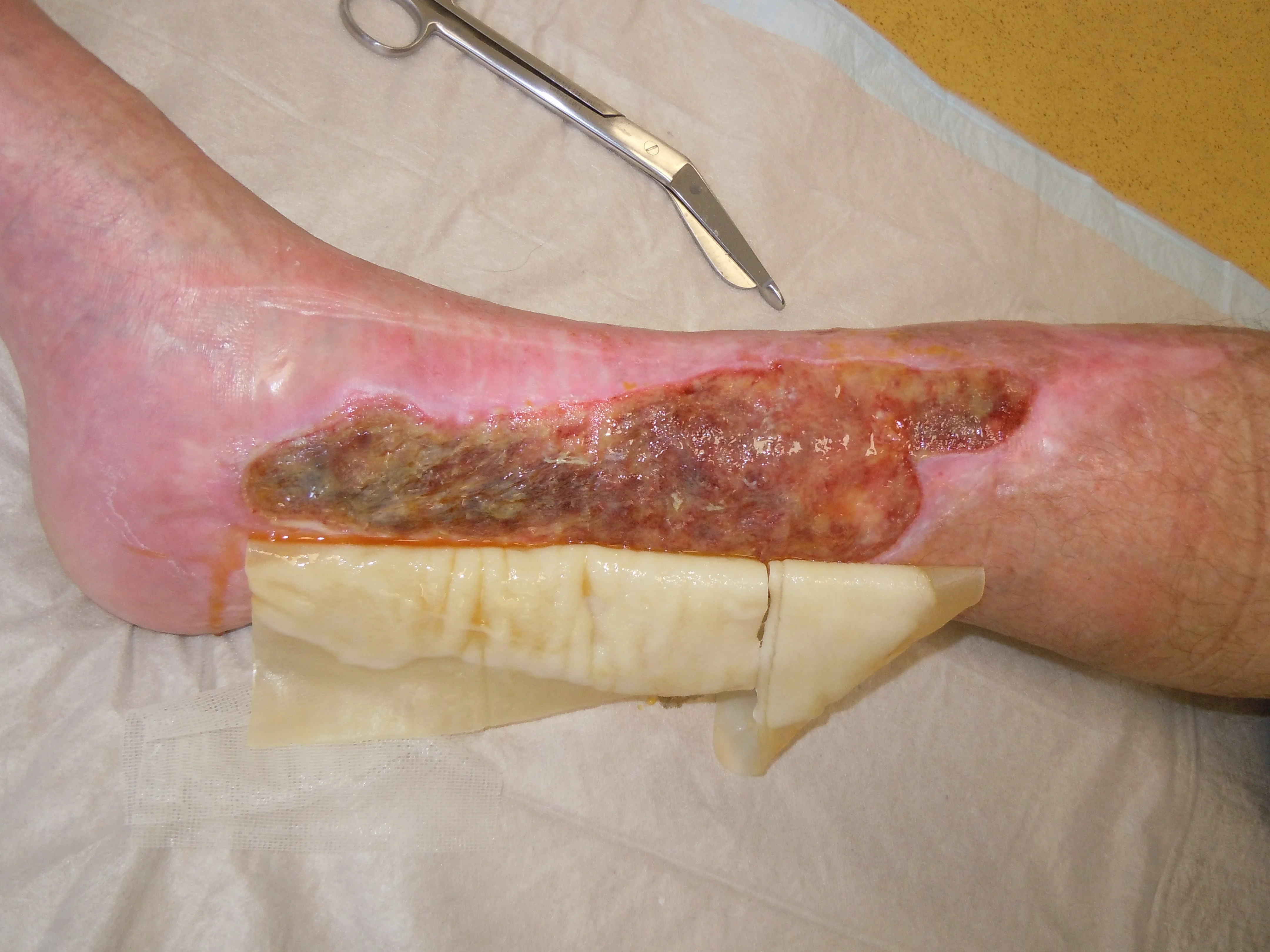 Artikel II - Bj&ouml;rn J&auml;ger