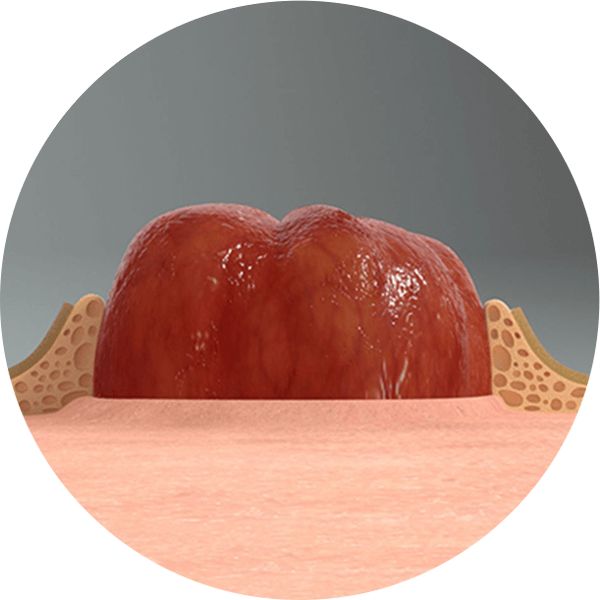 illustration of a skin barrier