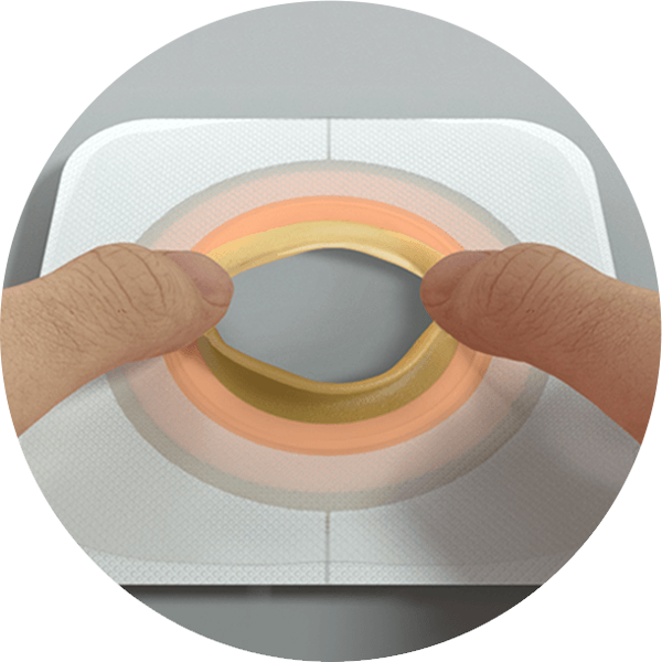 illustration of a skin barrier