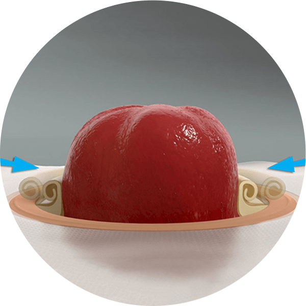 illustration of a skin barrier