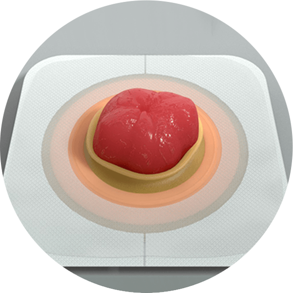 illustration of a skin barrier